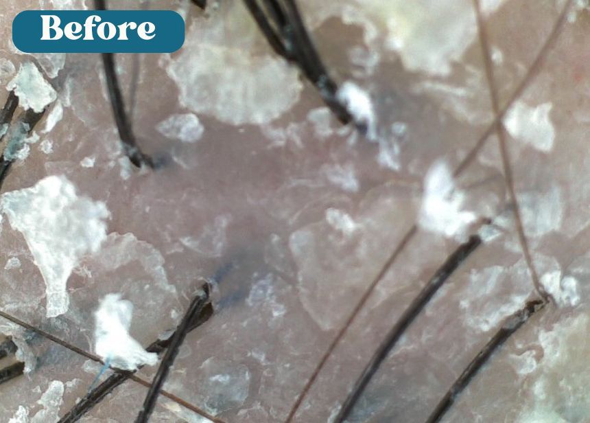 hair and scalp care for couples