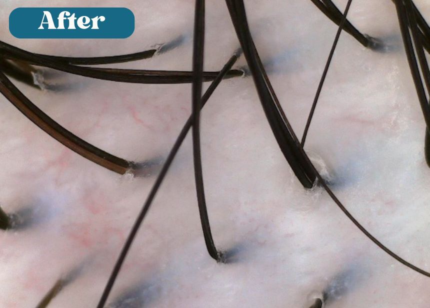 hair care solution Singapore